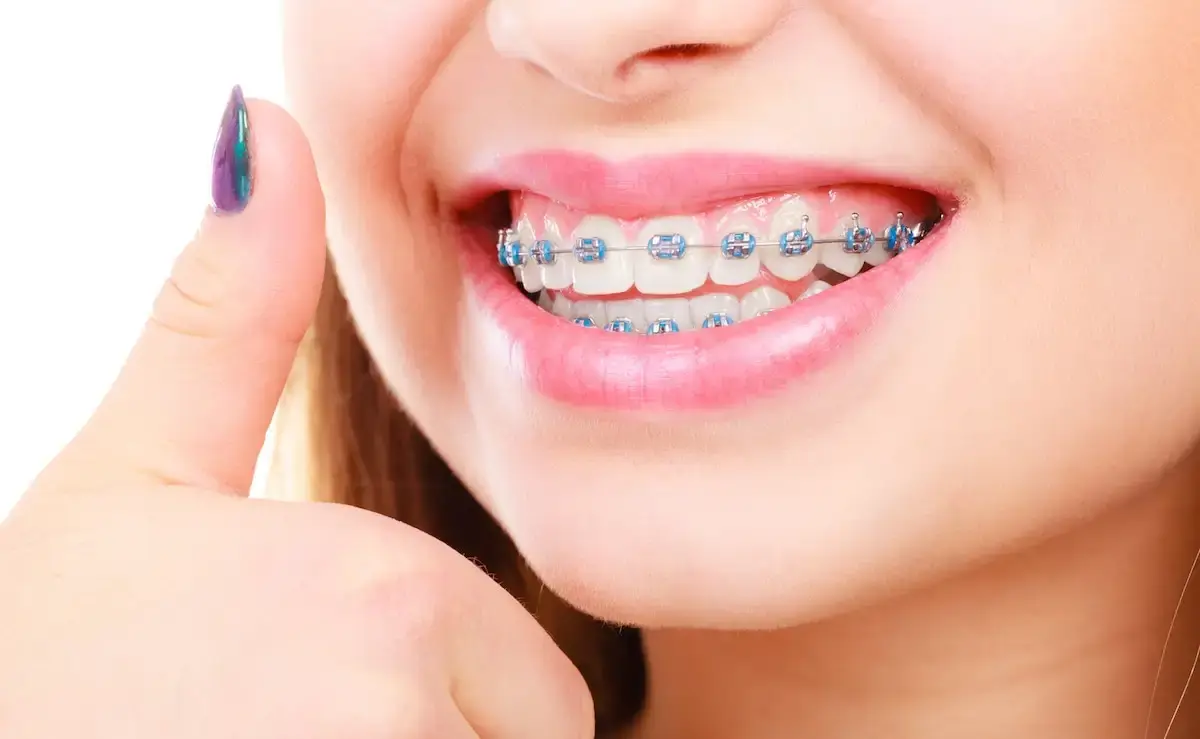 Before and after orthodontic treatment results